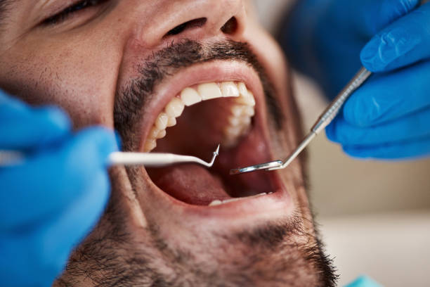 Best Emergency Treatment for Toothache in Shady Side, MD
