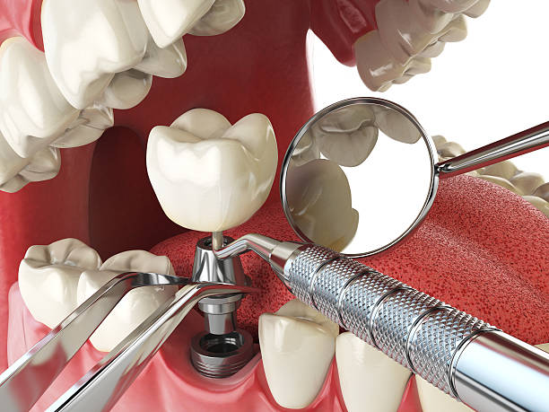 Best Emergency Treatment for Toothache in Shady Side, MD